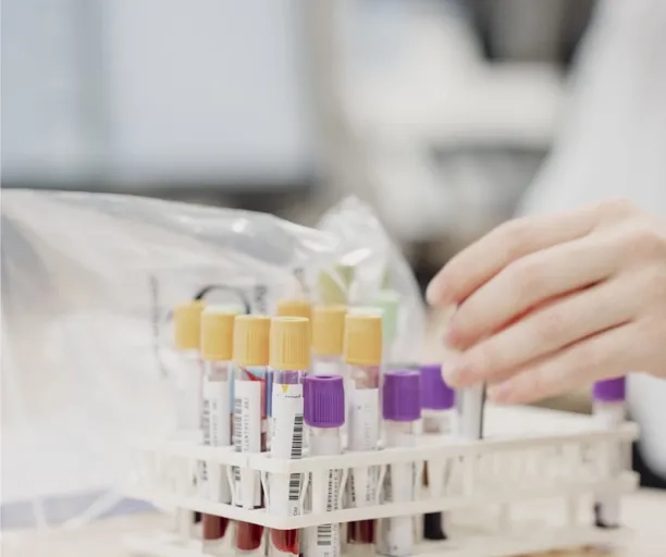 UniHA étend son marché de tests rapides en biologie pour mieux répondre aux besoins des établissements de santé
